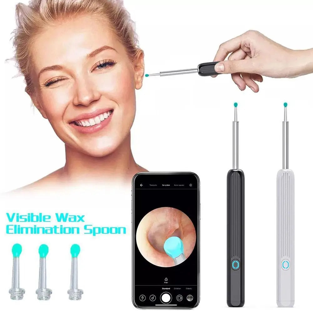 Visual Earwax Remover