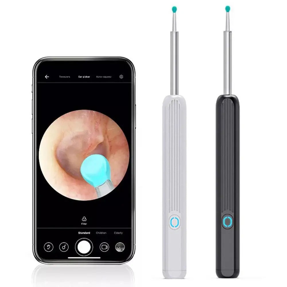 Visual Earwax Remover